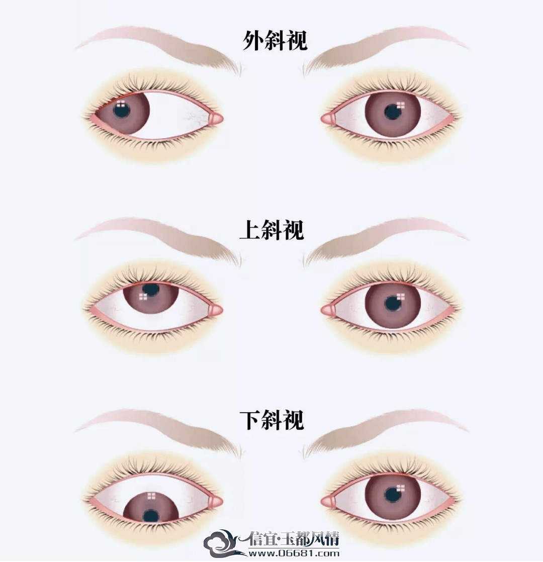 б��.png